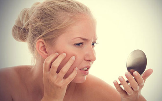 مصر اليوم - علاجات طبيعية لتقليل إفرازات البشرة الدهنية