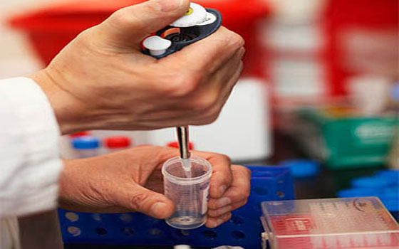   مصر اليوم - اكتشاف البروتين الذي يتسبب في انتشار السرطان