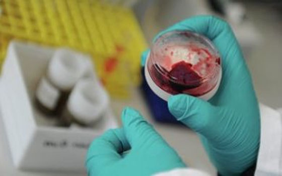   مصر اليوم - ارتفاع عدد الوفيات بفيروس كورونا في السعودية إلى 179