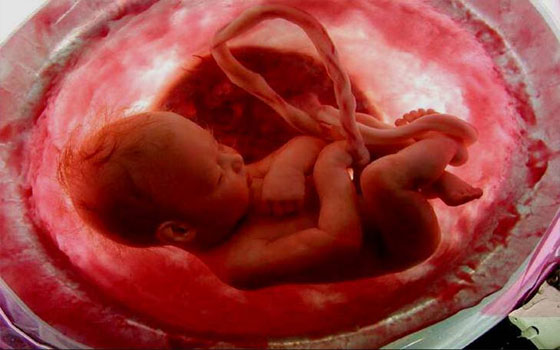   مصر اليوم - 80 ألف مولود فرنسي يعانون من تأخر في النمو وهم في الرحم