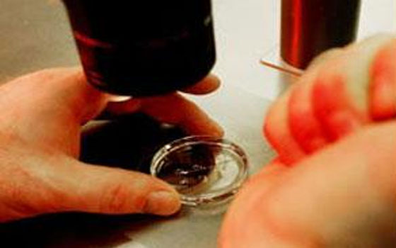   مصر اليوم - سرطان البنكرياس قد يصبح النوع الثاني من أشد أنواع السرطان فتكًا