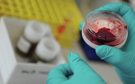   مصر اليوم - بريطانيا تكتشف حالة ثانية لفيروس كورونا لدى مسافر