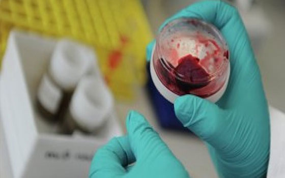   مصر اليوم - عزلُ حالتيّن مصابتيّن بـكورونا في ميّناء سفاجا البحري