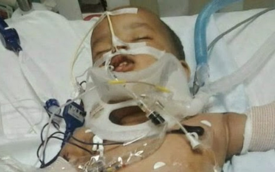   مصر اليوم - طفل يسقط من الطابق الـ11 في أميركا وينجو