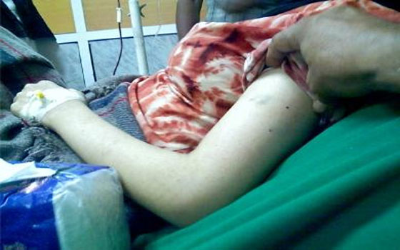   مصر اليوم - تحذير من تعرض ثلاث مدن برازيلية لوباء حمى الدنج