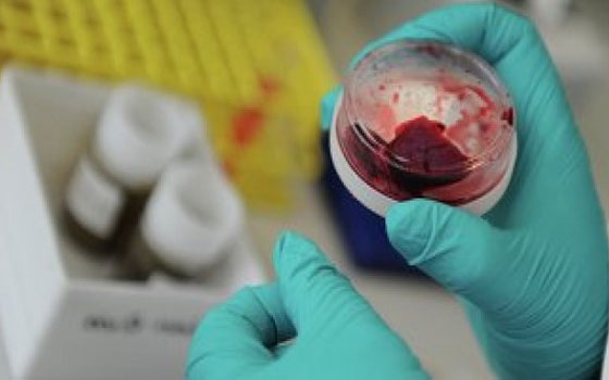   مصر اليوم - السعوديّة تناقش الوسائل والسبل لمكافحة فيروس كورونا