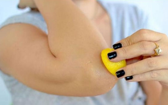   مصر اليوم - حل سحري لاسمرار الجلد عند الركبتين والمرفقين