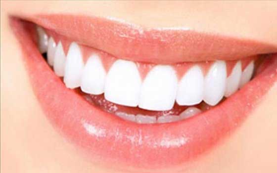   مصر اليوم - احصلي على ابتسامة ناصعة البياض طبيعيًا