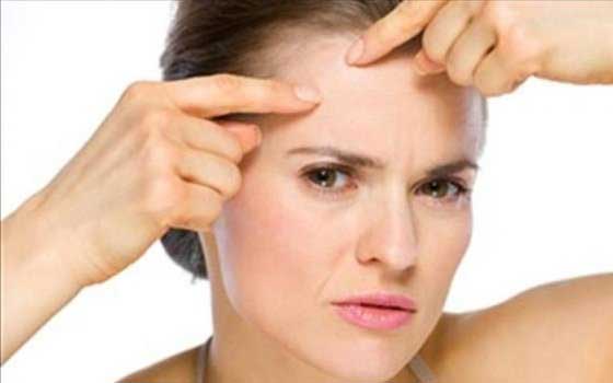   مصر اليوم - تخلصي من حَــب الشباب بهذه الخلطات