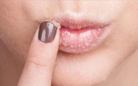 مصر اليوم - أقنعة منزلية لتقشير الشفاه