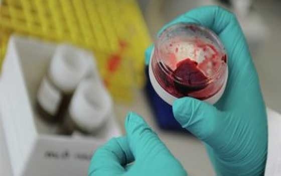   مصر اليوم - الصحة السعودية : وفاة حالة جديدة بفيروس كورونا