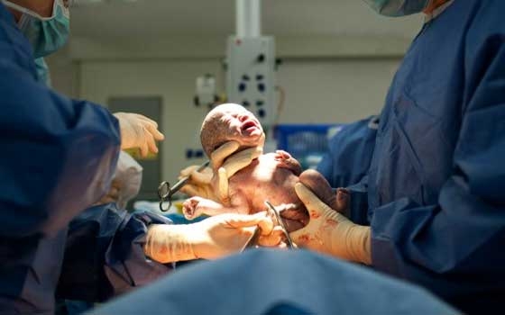   مصر اليوم - الأطباء في الإمارات يحذّرون من ارتفاع عدد الولادات القيصريّة