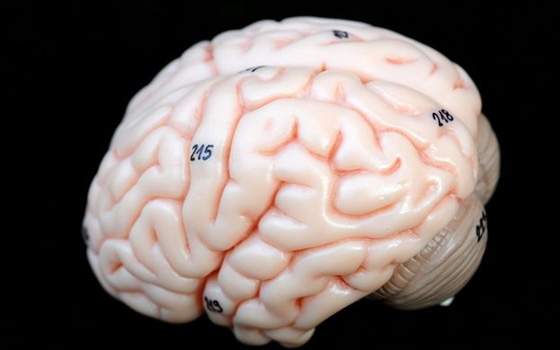   مصر اليوم - منع نشاط أنزيم يقلل تلف المخ عقب السكتات الدماغية