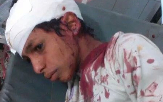   مصر اليوم - مقتل 8 أطفال بانفجار في إحدى المحال التُّجاريَّة في شمال اليمن