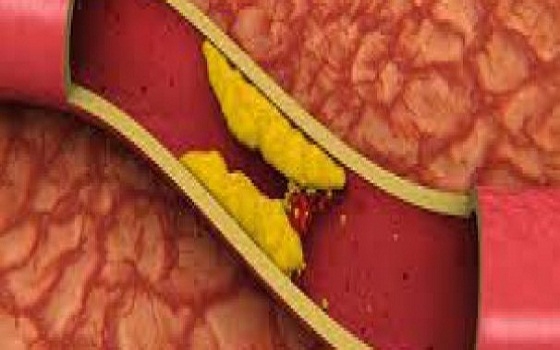   مصر اليوم - الصيام يساعد على استخدام الكولسترول كمصدر للطاقة