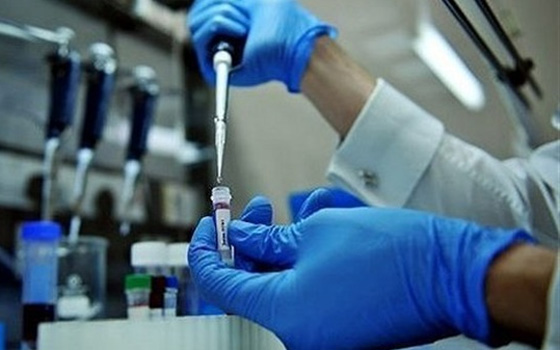   مصر اليوم - وزارة الصحة تُعلّن اكتشاف إصابة 5 حالات جديدة بـالملاريا