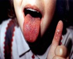 مصر اليوم - اكتشاف حالة إصابة بمرض الحمى القلاعية لأول مرة منذ 3 سنوات في كوريا