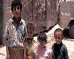 مصر اليوم - مليون و600 ألف طفل يمني معرضون للموت بسبب سوء التغذية