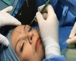 مصر اليوم - طبيب تجميل تركي يعلق فتوى تبيح عملياته