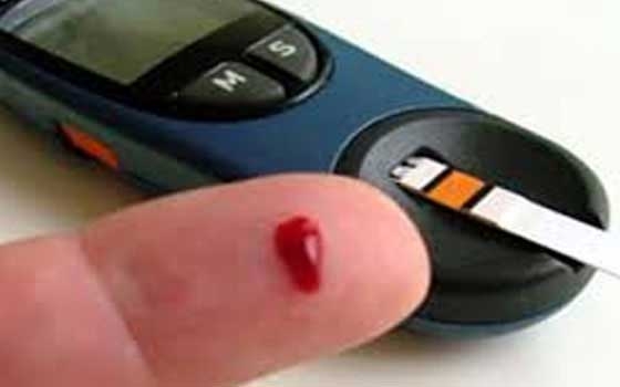   مصر اليوم - عمل الرجال بنظام الورديات يضاعف فرصهم في الإصابة بمرض السكري