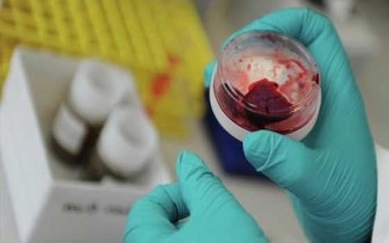 مصر اليوم - الصحة السعودية: لا إصابات جديدة الخميس بفيروس كورونا