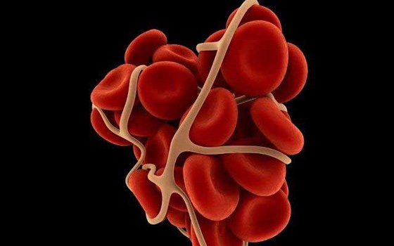   مصر اليوم - دراسة فرنسية: العقاقير المضادة للتجلط التى تأخذ بالفم آمنة