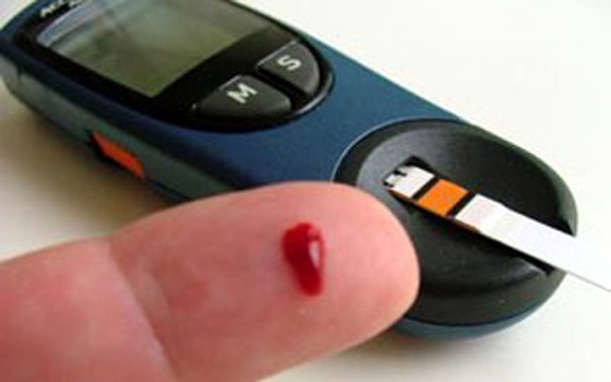   مصر اليوم - حقن فئران التجارب بالبروتين يخفض مستوى السكر في الدم مؤقتا