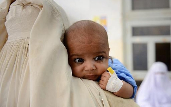   مصر اليوم - دراسة: سل الأطفال مشكلة صحية مستخف بها