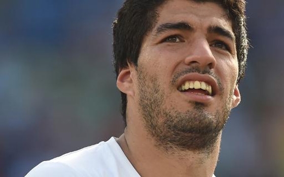   مصر اليوم - شركات صينية تعرض فتاحات قناني مستوحاة من عضة سواريز