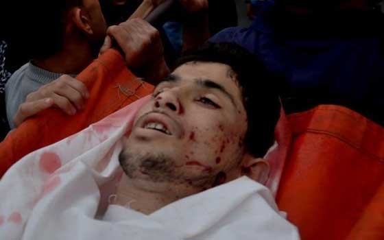   مصر اليوم - استشهاد 174 وإصابة 1150 جراء الاعتداءات الإسرائيليَّة على قطاع غزّة