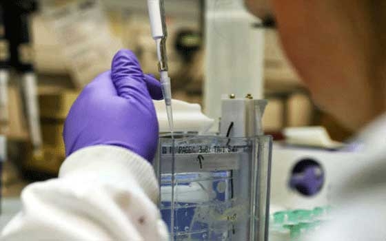   مصر اليوم - دراسة تمهد الطريق لاختبار بسيط للدم للتنبؤ بالزهايمر