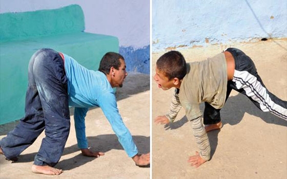   مصر اليوم - مأساة عائلة مغربيَّة يمشي أبناؤها على أربع