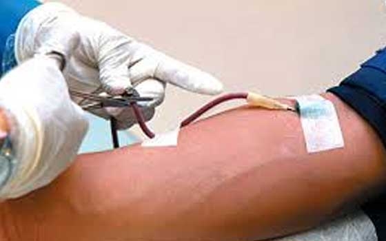   مصر اليوم - بدء دورة عن الأمراض المعدية والمنقولة عبر الدم في عدن