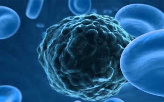   مصر اليوم - فيروس الحصبة يساعد في علاج السرطان