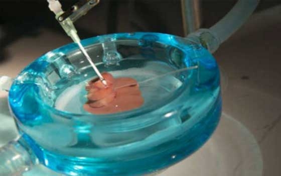   مصر اليوم - تراجع في أعداد المتبرعين بالأعضاء في ألمانيا في النصف الأول