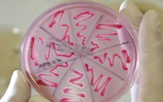   مصر اليوم - تشريح وتحليل البكتيريا المعوي غير المعروفة حتى الآن