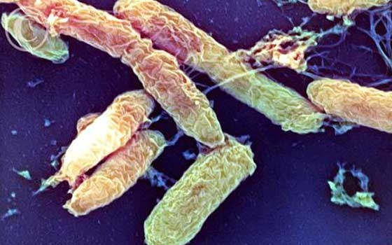   مصر اليوم - احتفالية بمرور 120 عامًا على اكتشاف بكتريا مرض الطاعون