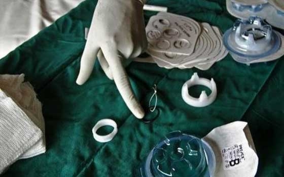   مصر اليوم - ختان الرجال يخفض من مخاطر الإصابة بفيروس الإيدز