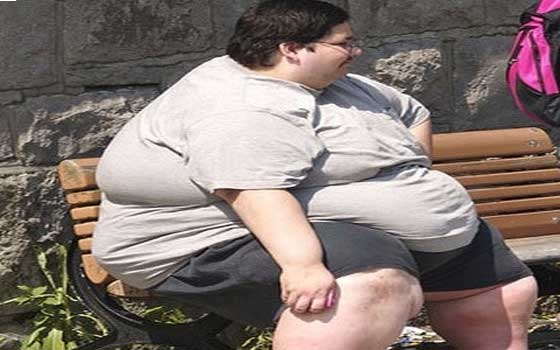   مصر اليوم - السمنة قد تؤدي إلى خطر الانسداد الرئوي المزمن
