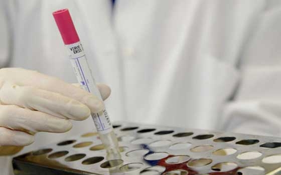   مصر اليوم - وزارة الصحة السعودية : 3 اصابات جديدة بفيروس كورونا