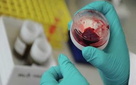 مصر اليوم - الصحة السعودية: وفاة حالة جديدة بفيروس كورونا وشفاء حالتين