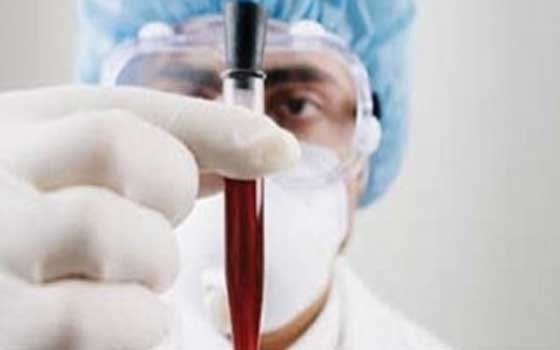 مصر اليوم - الصحة السعودية تؤكد عدم وجود إصابات جديدة بفيروس كورونا