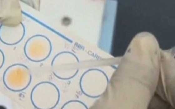   مصر اليوم - أكتشاف أول حالتي إصابة بفيروس الأيبولا القاتل في أميركا