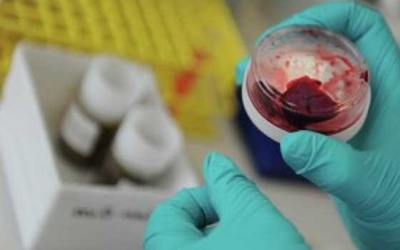   مصر اليوم - الصحة السعودية : حالتا وفاة وإصابة جديدتان بفيروس كورونا