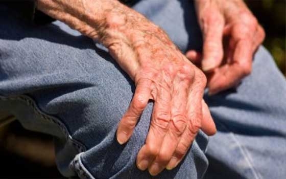   مصر اليوم - علماء يكتشفون عوامل خطر جينية جديدة متعلقة بمرض الشلل الرعاش