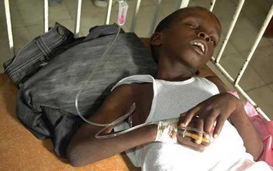 مصر اليوم - وفاة خمسة أشخاص بداء الكوليرا في جنوب شرق نيجيريا