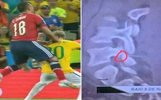   مصر اليوم - نيمار مهدد بالغياب عن الملاعب مابين 6 أسابيع أو 7 شهور بسبب إصابة الظهر