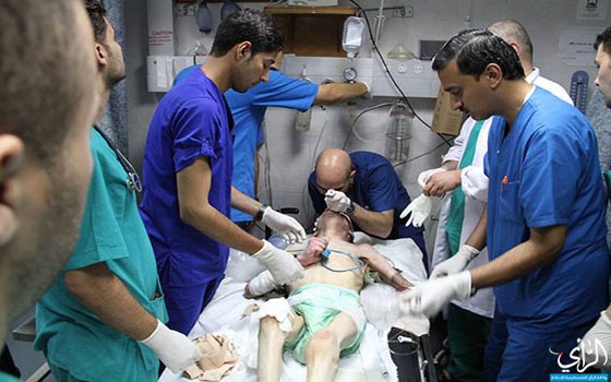   مصر اليوم - إرتفاع حصيلة العدوان الإسرائيلي إلى 172 شهيدا و1230 جريحًا