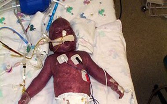   مصر اليوم - 50 إصابة جديدة بالإيبولا ووفاة 25 غرب أفريقيا