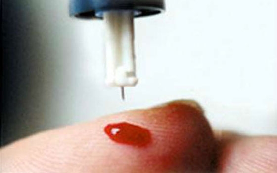   مصر اليوم - تحليل دم بسيط يكشف جميع أنواع السرطان